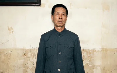 Cancer de l’Intestin : Cinq Ans Sans Récidive grâce à Tian Xian